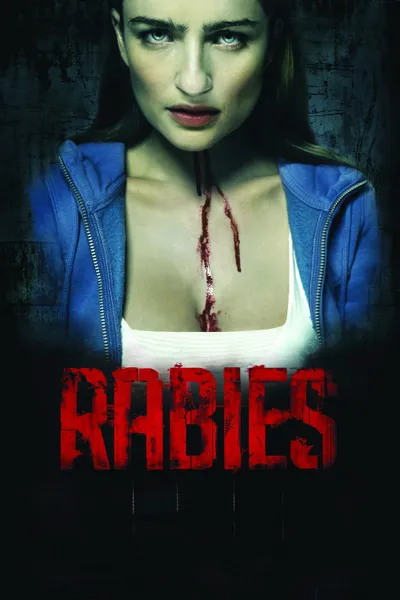 Rabies