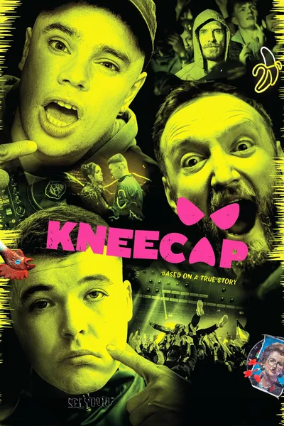 Kneecap